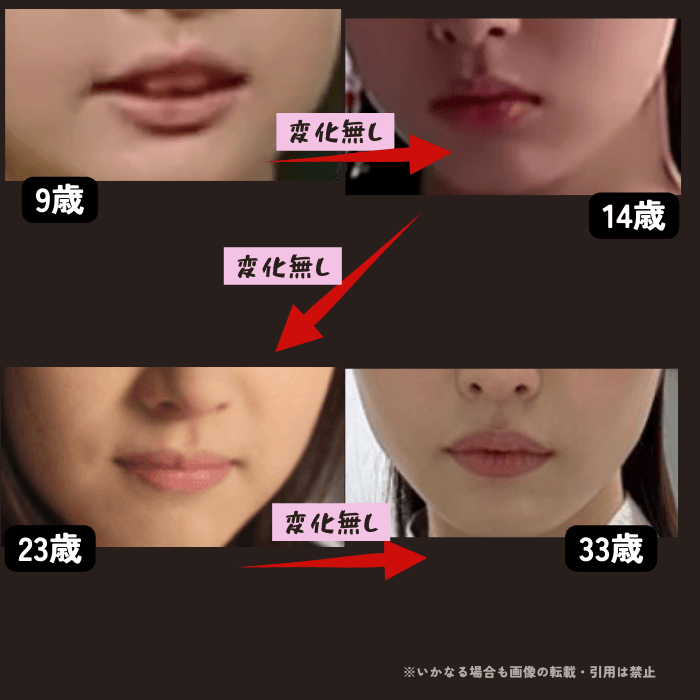 韓国女優シンセギョンの唇の変化について時系列検証画像
以下4枚の画像

9歳（左上画像）
14歳（右上画像）
23歳（左下画像）
33歳（右下画像）

時系列で確認しても、唇の形に変化が無いことがわかる